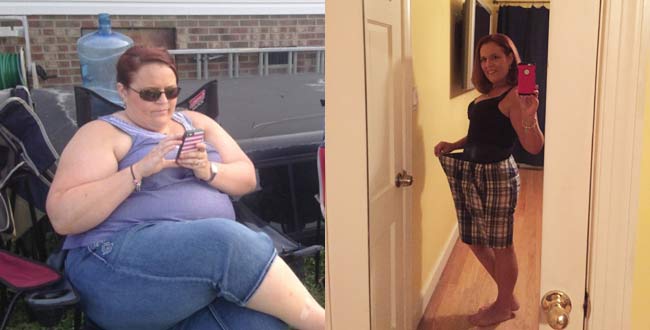 Lose weight post surgery